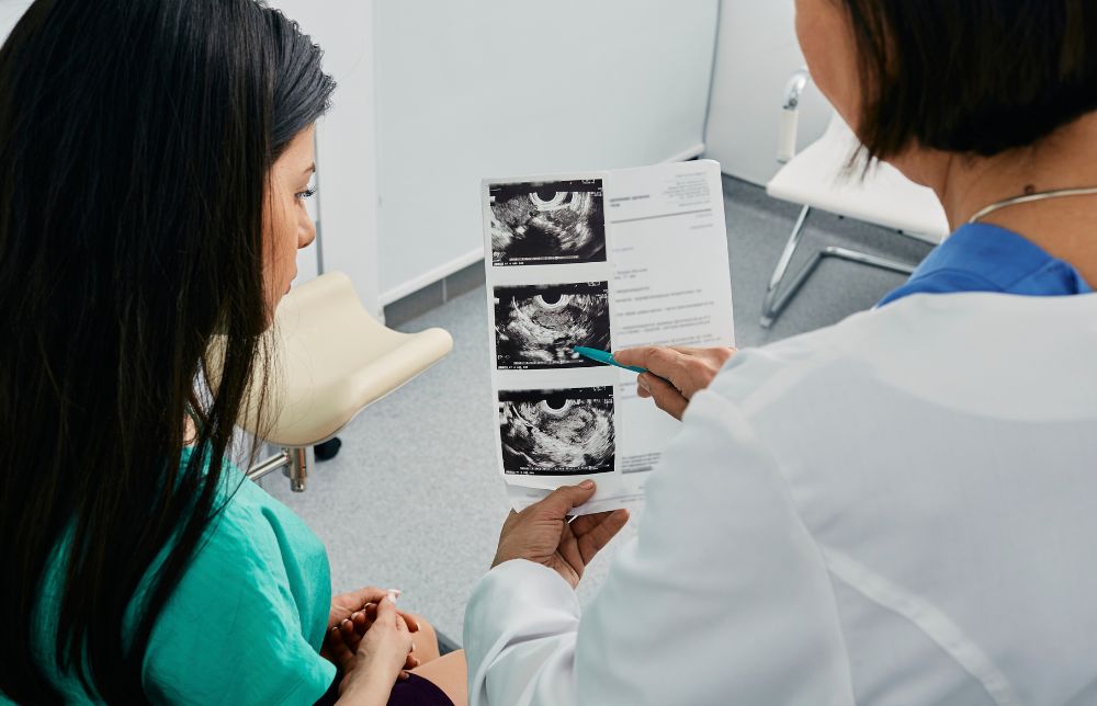 Leczenie PCOSLeczenie PCOS